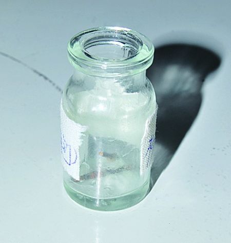 男子肾脏里存在一根4厘米铁钉达20年(图)
