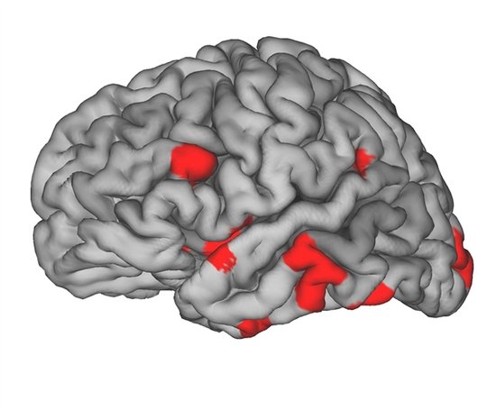 科学家在大脑中发现12个与爱情有关区域(图)