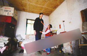 29岁男子身高达2.24米 患上怪病仍在长高