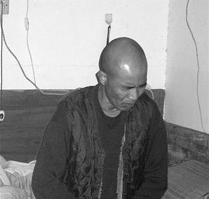 男子怪病缠身见光会“中暑” 听见喧哗就抽搐