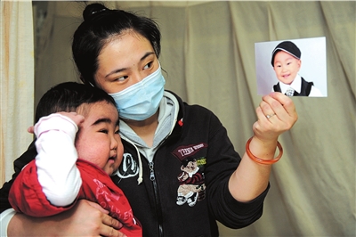 三龄童患怪病恐失明 服用药物变成“毛孩”(图)