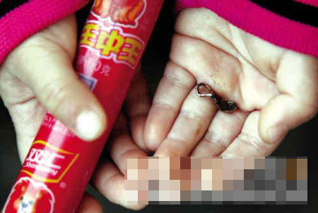 女童吃双汇火腿肠吃出生锈铜圈 索赔遭推脱(图)