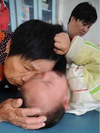 两岁小孩体内长两种性别生殖器 被认为怪胎(图)