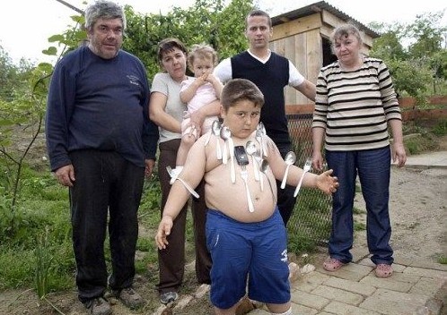 克罗地亚男孩身体能吸金属50斤 可自由控制(图)