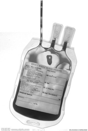 自体血最安全最省钱 患者不知情医生不用