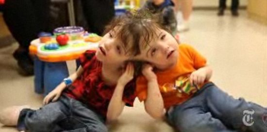 连体人探秘 可共享思想分享感受(组图)