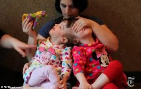 连体人探秘 可共享思想分享感受(组图)