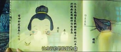 女婴脸面凹陷 仅1岁就需“撑骨”整形(图)