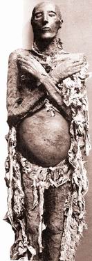 揭秘俄罗斯600岁女尸产活婴真相