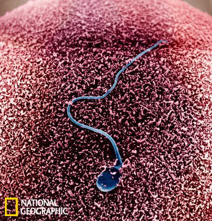 电子显微镜观测到，一个精子与一个卵子相遇。