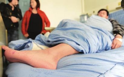 四川大学华西医院，小伙脚上的小伤口导致生命危险。