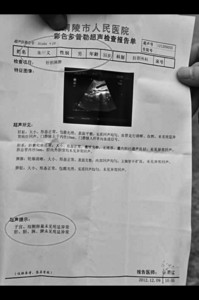 男子彩超显示子宫、卵巢未见明显异常