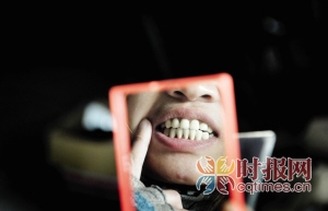 巴南区李家沱，何女士看到美容后的12颗牙齿总是心头不舒服。