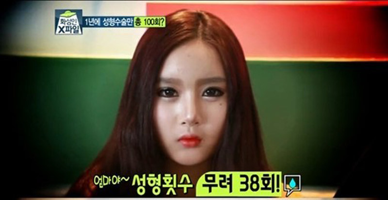 图中韩国女性1年内共整容38次(韩国电视台播放画面截图)