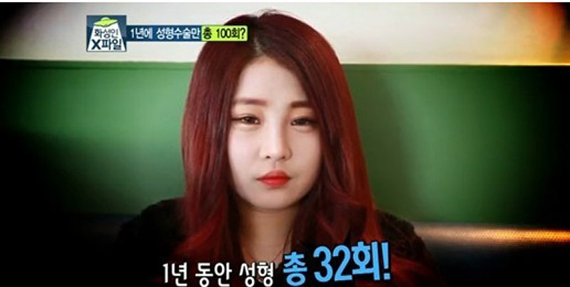 图中韩国女性1年内共整容32次(韩国电视台播放画面截图)