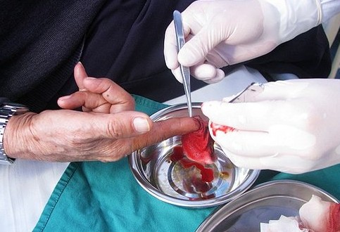 杜爹爹正在医院接受治疗