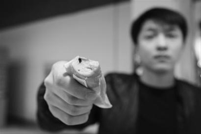 昨日，市民隋先生购买了一袋双汇火腿肠，发现其中一个火腿肠中有异物