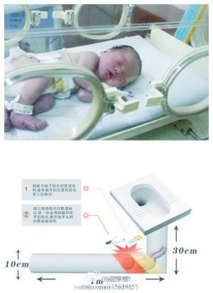 男婴被卡厕所下水管道经解救生还。