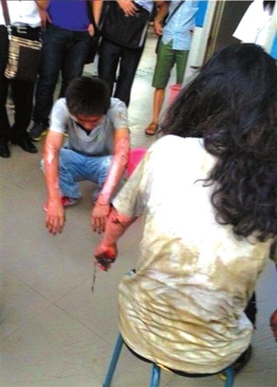 两名伤者心有余悸