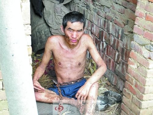 13年来，阿奇的人生半径就是这条铁链的长度。