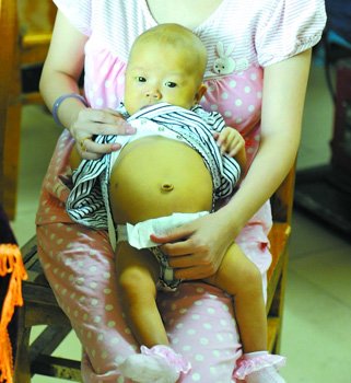 四个月女儿患多种疾病 年轻妈妈欲切肝救女