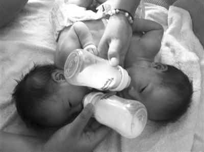 “天使之家”工作人员为连体弃婴喂奶粉