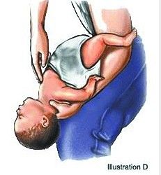 亲友执意喂食 1岁半幼女<a href=