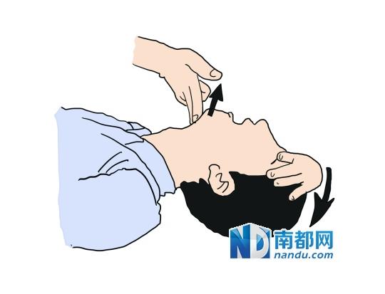 广东急救专家呼吁普及心肺复苏术应对晕厥者