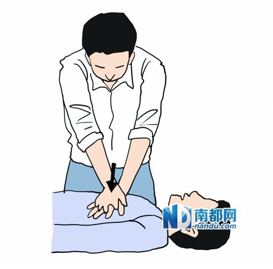 广东急救专家呼吁普及心肺复苏术应对晕厥者