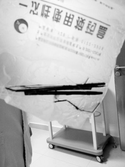 这根最终断成四截的筷子就是从胡先生胃中取出来的。