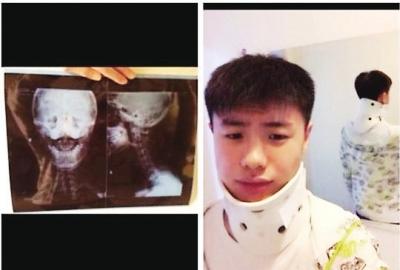 “翻跟斗亲亲”模仿火爆 用生命秀恩爱有危险